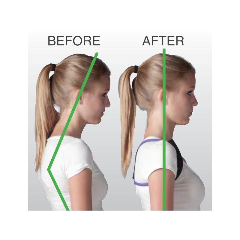 Posture Medic - Back Brace